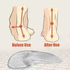 Orthopedic Gel Insoles for Arch Support - Medical Silicone, 12 cm or 13 cm, view 5