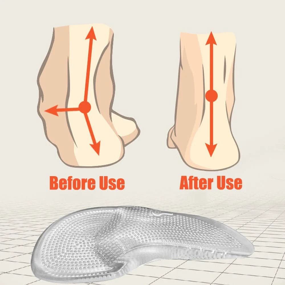 Orthopedic Gel Insoles for Arch Support - Medical Silicone, 12 cm or 13 cm, view 5