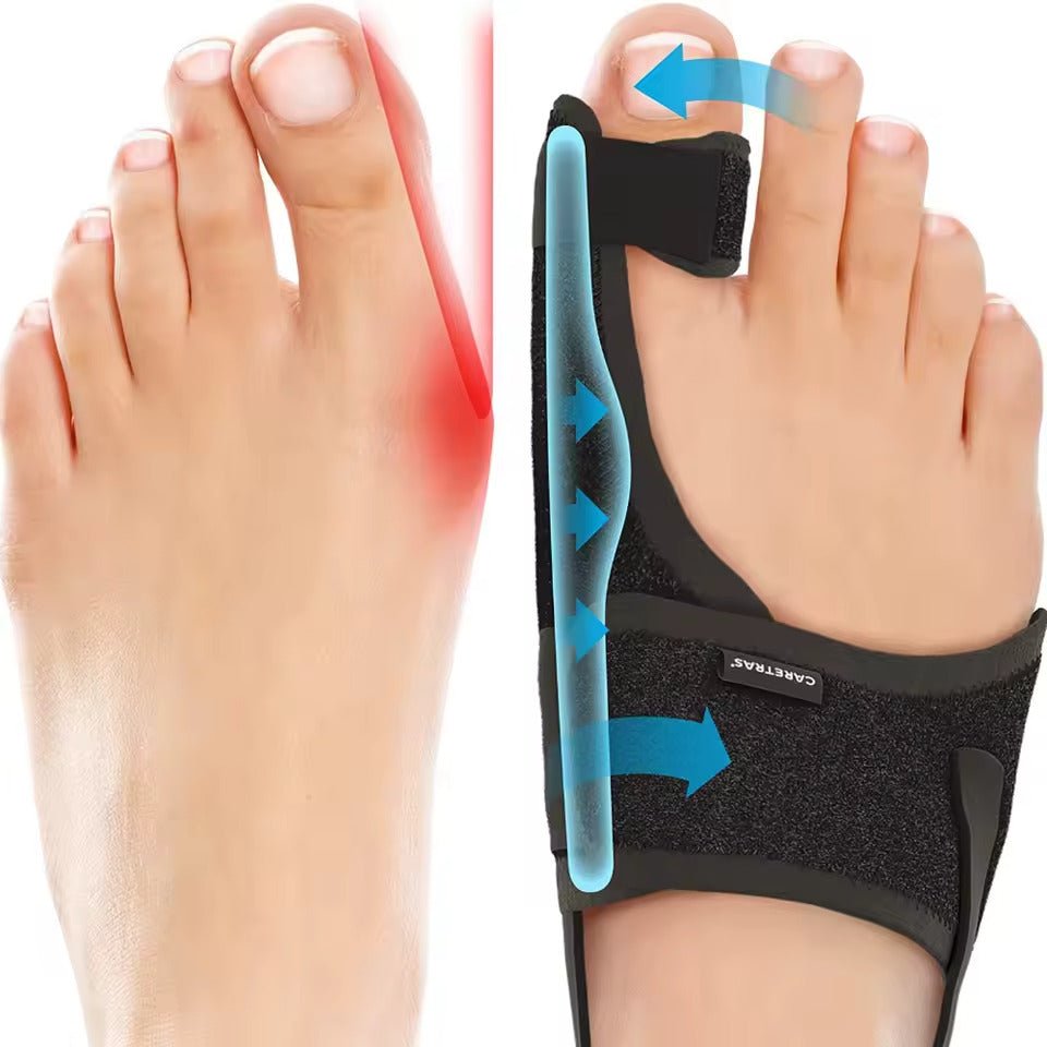 Night Splint for Hallux Valgus - Ergonomic Adjustable Support, view 5