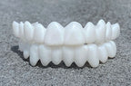 Dental Prosthesis with White Veneers, Lightweight Reusable Resin