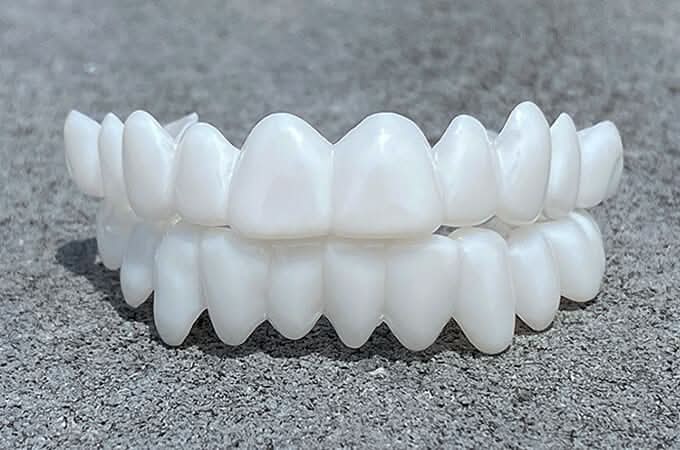 Dental Prosthesis with White Veneers, Lightweight Reusable Resin