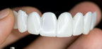 Dental Prosthesis with White Veneers, Lightweight Reusable Resin