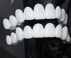 Dental Prosthesis with White Veneers, Lightweight Reusable Resin