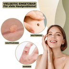DermaLinx Wart Remover for Home Use