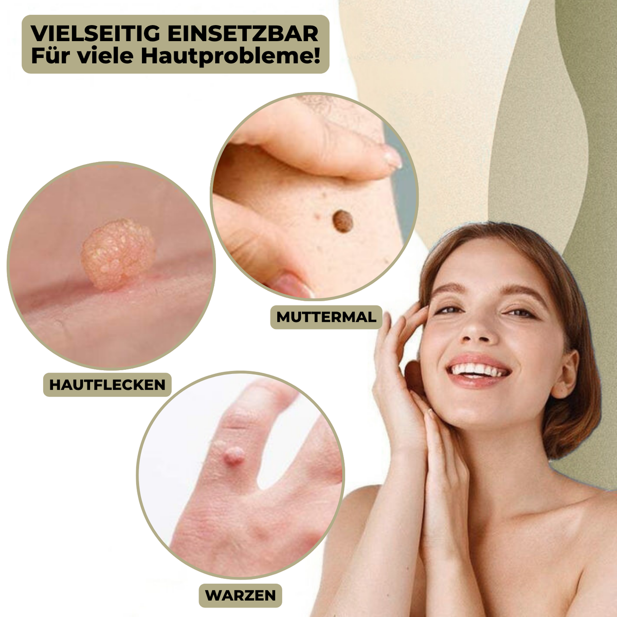 DermaLinx Wart Remover for Home Use