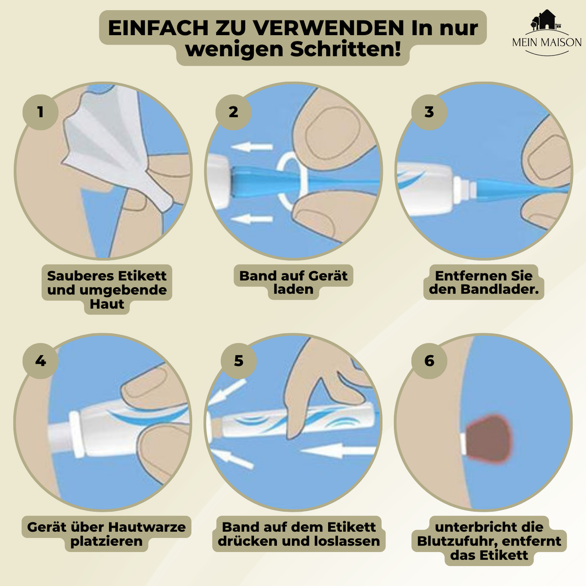 DermaLinx Wart Remover for Home Use