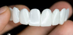 Cosmetic Tooth Toppers for Smile Enhancement - Reusable Flexible Resin, view 4