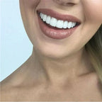 Snap-On Dental Restoration Veneers - Durable Plastic, Stain Resistant, Reusable, view 3