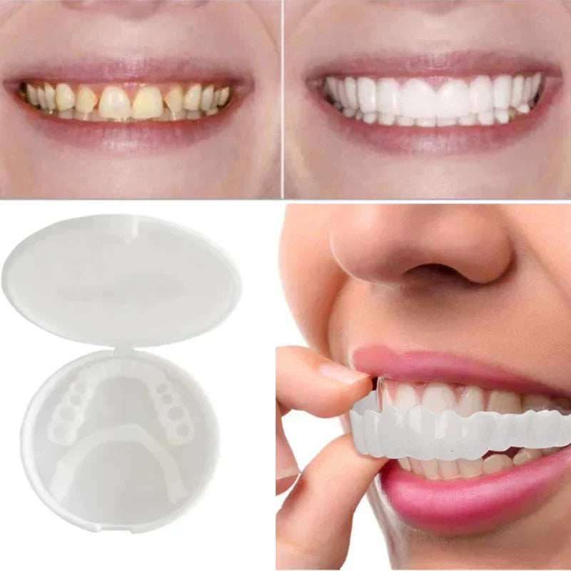 Snap-On Dental Restoration Veneers - Durable Plastic, Stain Resistant, Reusable, view 4