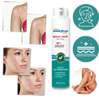 Scar Removal Spray Treatment - 20 g, Allergy-Friendly, For All Skin Types, view 2