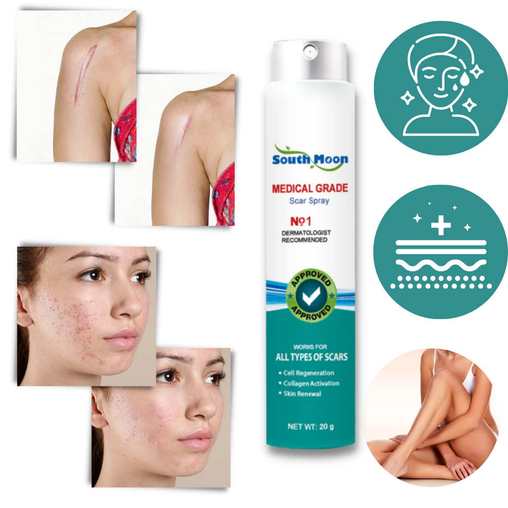 Scar Removal Spray Treatment - 20 g, Allergy-Friendly, For All Skin Types, view 2