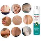 Scar Removal Spray Treatment - 20 g, Allergy-Friendly, For All Skin Types, view 3