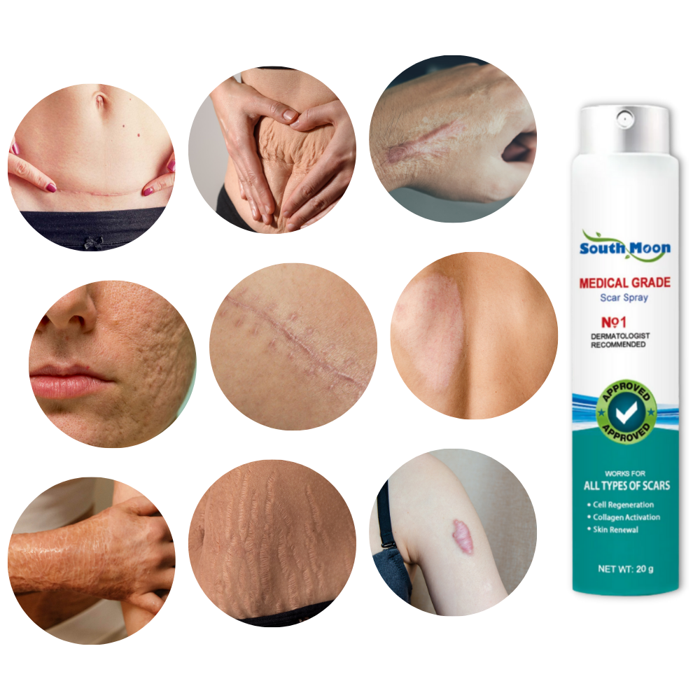 Scar Removal Spray Treatment - 20 g, Allergy-Friendly, For All Skin Types, view 3