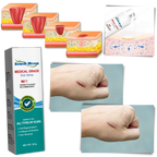 Scar Removal Spray Treatment - 20 g, Allergy-Friendly, For All Skin Types, view 4