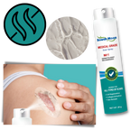Scar Removal Spray Treatment - 20 g, Allergy-Friendly, For All Skin Types, view 5