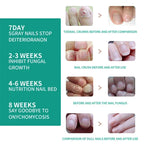 Nail Fungus Defender Serum - 10ml Nail Treatment, Repairs Damaged Nails, view 10