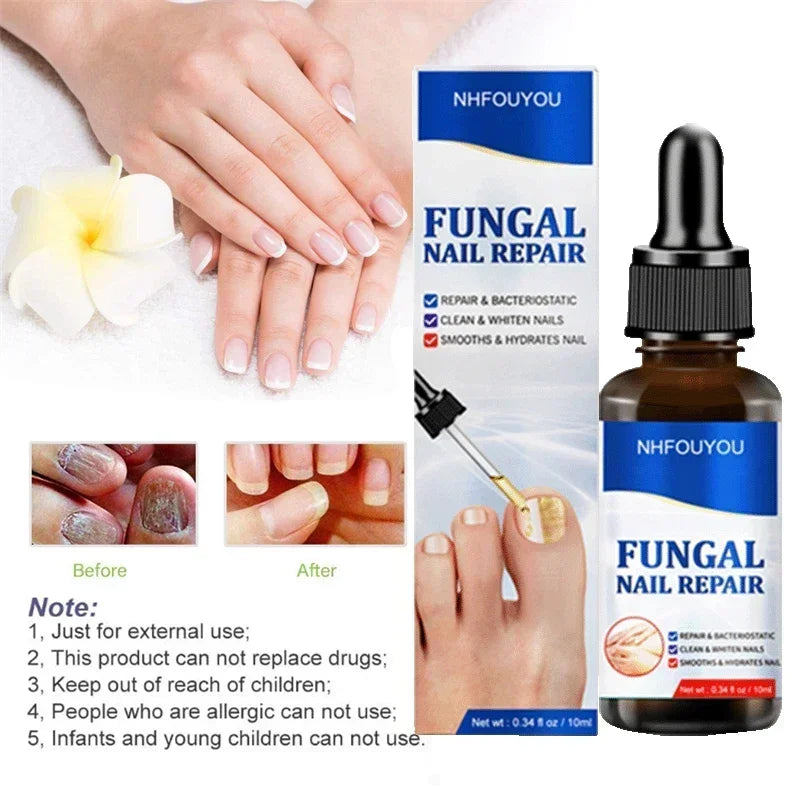 Nail Fungus Defender Serum - 10ml Nail Treatment, Repairs Damaged Nails, view 12