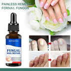 Nail Fungus Defender Serum - 10ml Nail Treatment, Repairs Damaged Nails, view 2