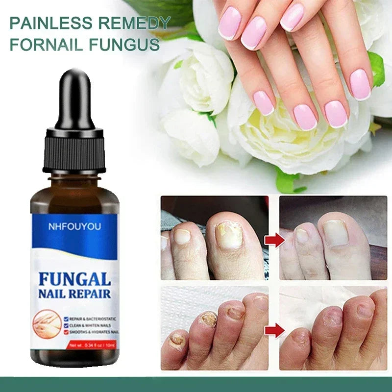 Nail Fungus Defender Serum - 10ml Nail Treatment, Repairs Damaged Nails, view 2