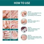 Nail Fungus Defender Serum - 10ml Nail Treatment, Repairs Damaged Nails, view 3