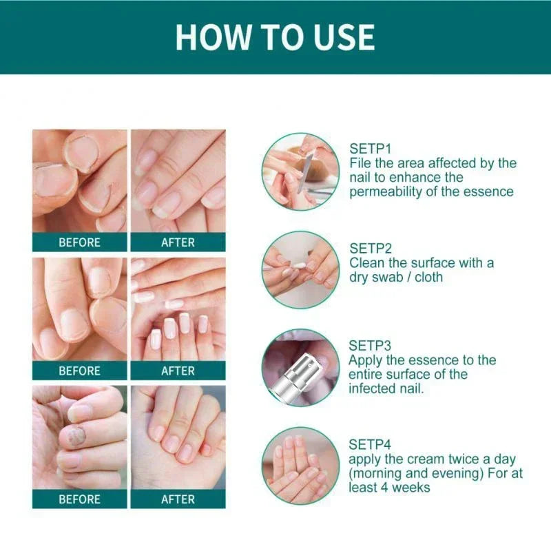 Nail Fungus Defender Serum - 10ml Nail Treatment, Repairs Damaged Nails, view 3