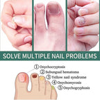 Nail Fungus Defender Serum - 10ml Nail Treatment, Repairs Damaged Nails, view 5