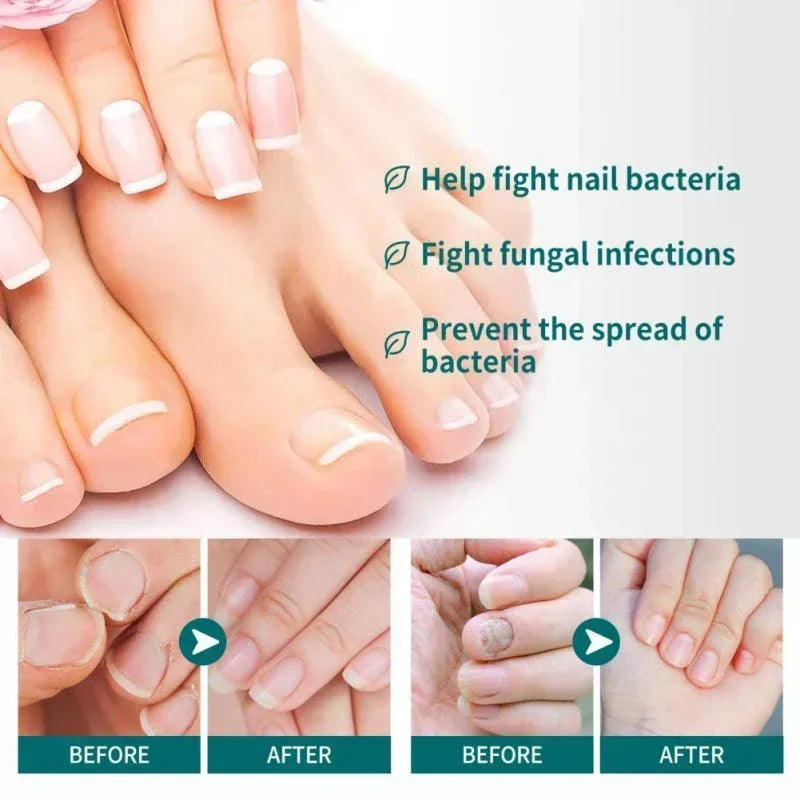 Nail Fungus Defender Serum - 10ml Nail Treatment, Repairs Damaged Nails, view 6