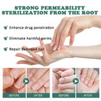 Nail Fungus Defender Serum - 10ml Nail Treatment, Repairs Damaged Nails, view 7