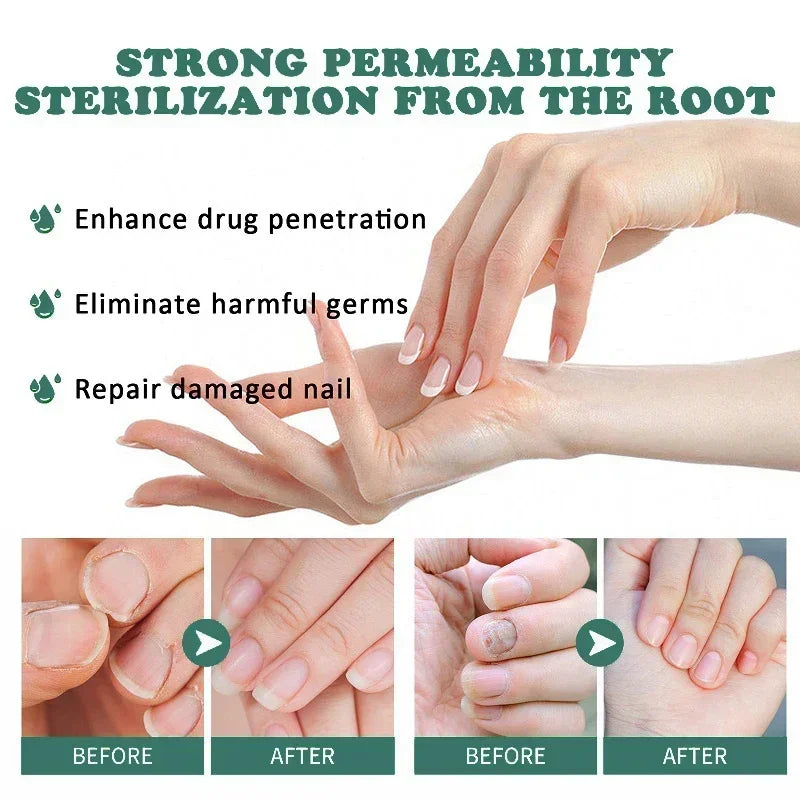 Nail Fungus Defender Serum - 10ml Nail Treatment, Repairs Damaged Nails, view 7