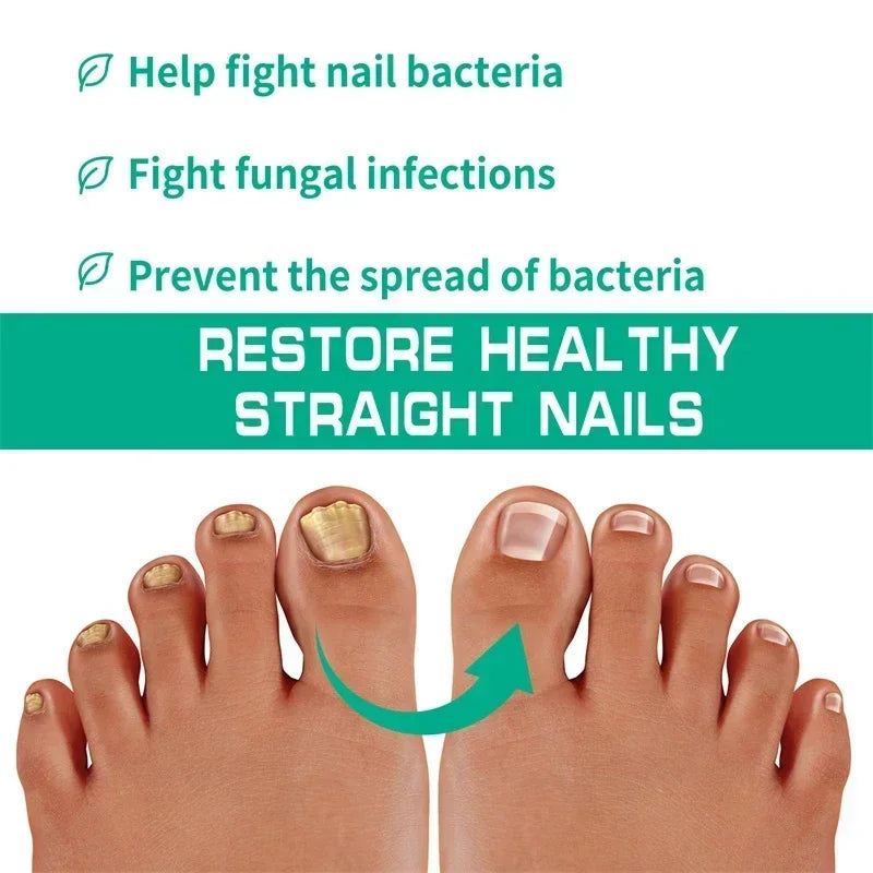 Nail Fungus Defender Serum - 10ml Nail Treatment, Repairs Damaged Nails, view 8