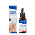 Nail Fungus Defender Serum - 10ml Nail Treatment, Repairs Damaged Nails