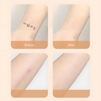 Waterproof Scar Concealer Patch - Sweat-Proof, 13 x 8.5 cm, view 5