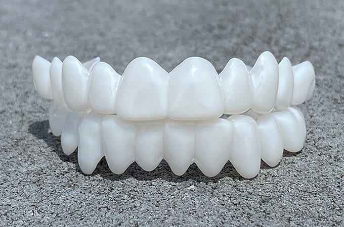 Dental Veneers for Natural Fit and Comfort - Easy to Use, 18 Month Lifespan, view 2