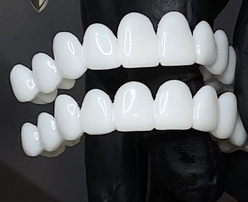 Dental Veneers for Natural Fit and Comfort - Easy to Use, 18 Month Lifespan, view 5