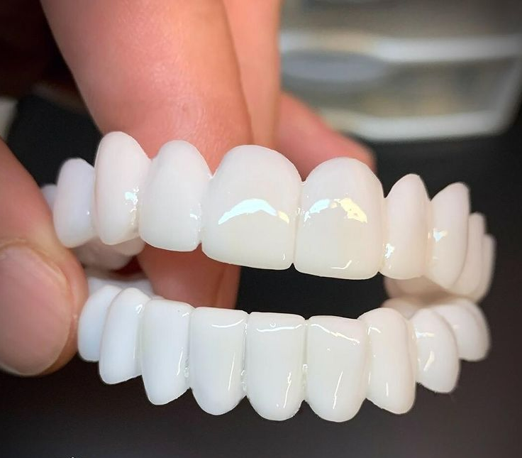 Dental Veneers for Natural Fit and Comfort - Easy to Use, 18 Month Lifespan