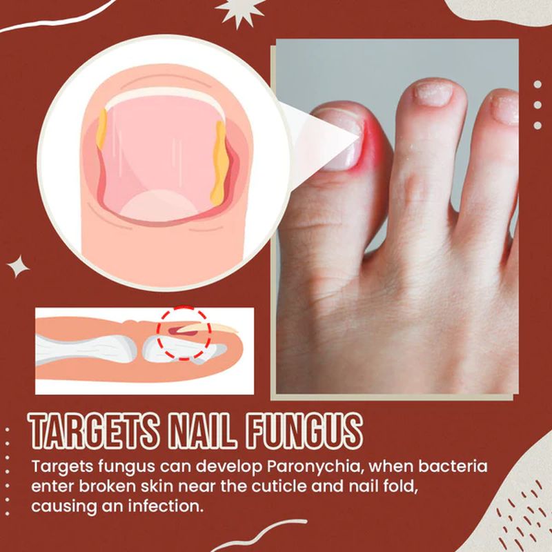 Nail Anti-Fungus Socks for Men and Women - Black, Red, White, view 7