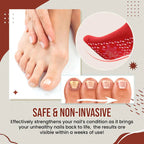 Nail Anti-Fungus Socks for Men and Women - Black, Red, White, view 9