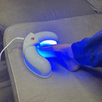 Portable Nail Fungus Laser Device, Handheld, USB Rechargeable