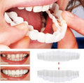 Removable Snap-On Veneers for Upper and Lower Jaw, Acrylic Resin Set
