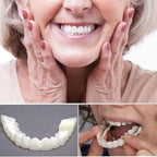 Removable Snap-On Veneers for Upper and Lower Jaw, Acrylic Resin Set