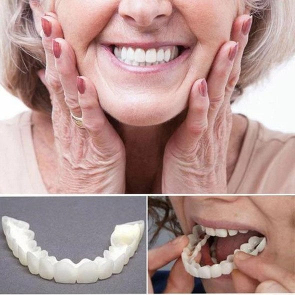 Removable Snap-On Veneers for Upper and Lower Jaw, Acrylic Resin Set